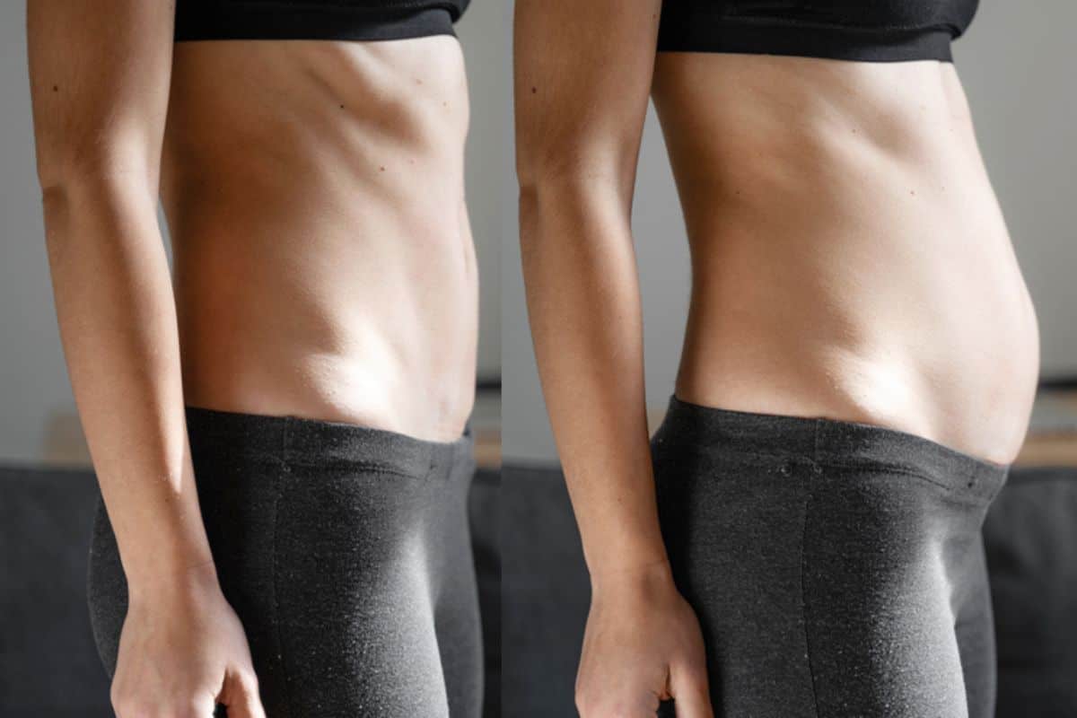 How long does diastasis recti take to improve Streatham?