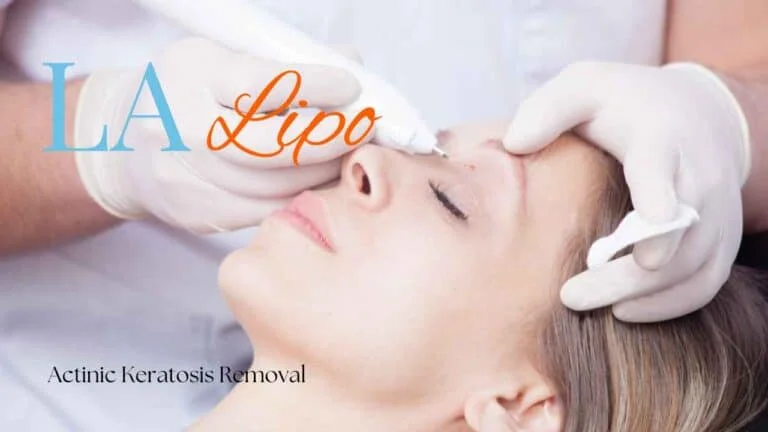 Woman receiving Actinic Keratosis Removal Treatment Streatham