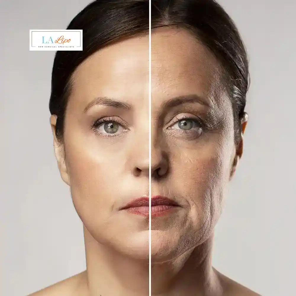 How Can You Tell If Non-Surgical Skin Tightening Is Right for You Streatham?
