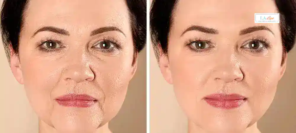 Why Aren’t My Skincare Products Making My Sagging Skin Look Firmer Streatham?