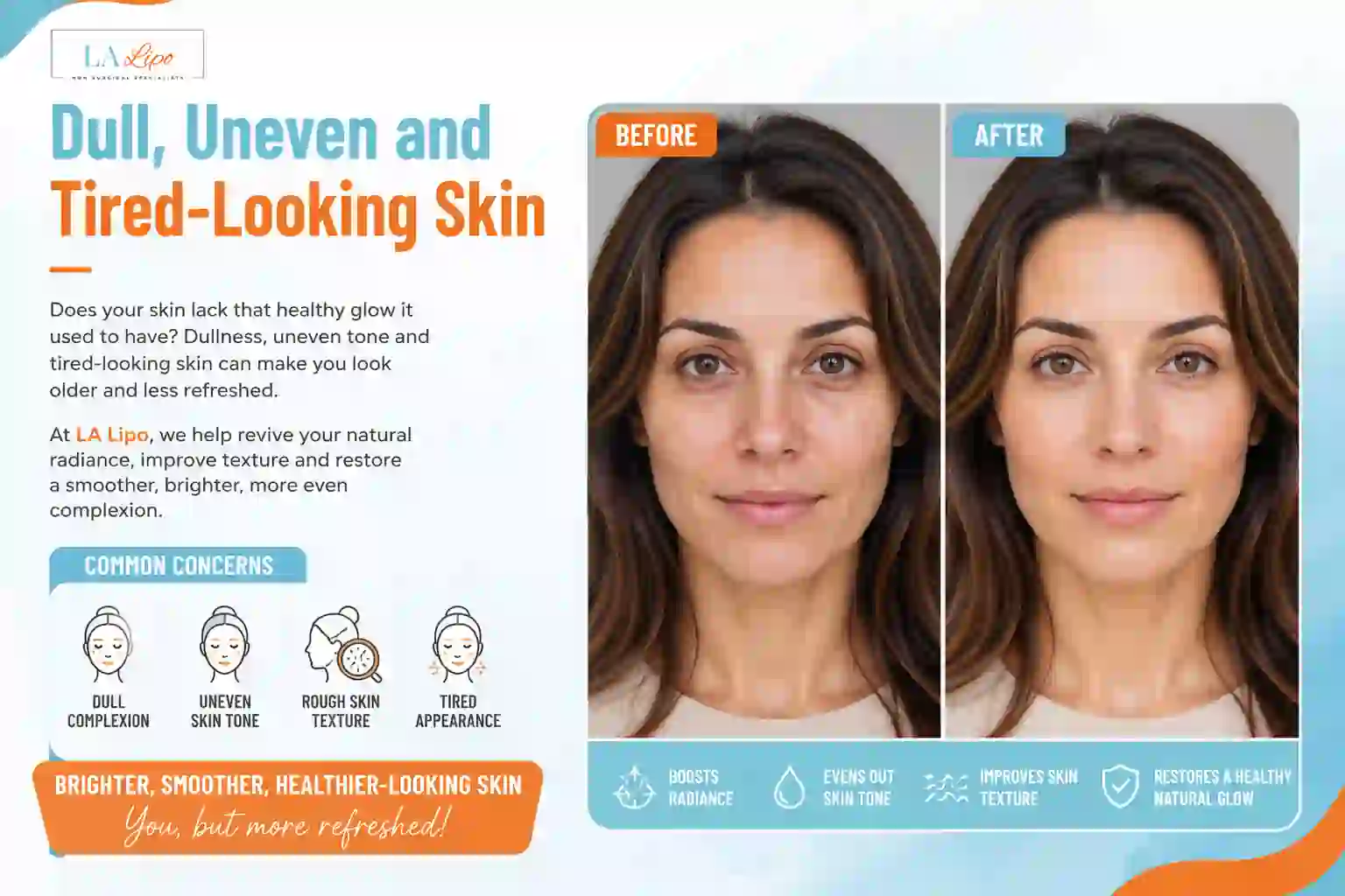 Sign #5: Dull, Uneven and Tired-Looking Skin Streatham