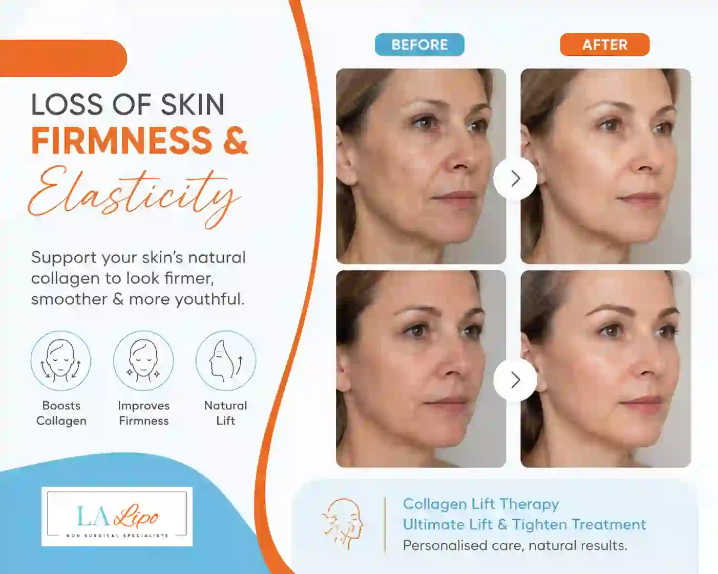Sign #7: Loss of Skin Firmness and Elasticity Streatham